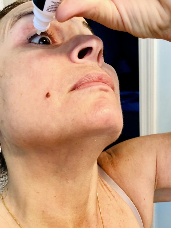 Comprendre et traiter la sécheresse oculaire à paris